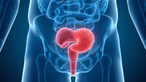 Comparison diagram showing normal prostate size versus enlarged prostate in men over 50